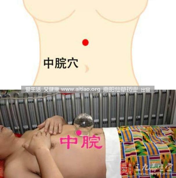 中脘穴位于腹部正中線，臍上4寸的位置上。每天艾灸10-15分鐘，能有效緩解胃部不適的癥狀，同時有助于祛濕。