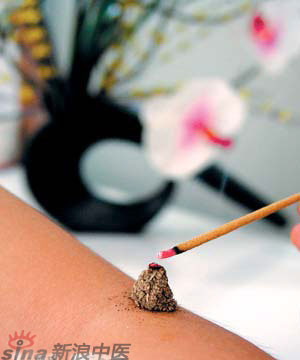 節(jié)氣灸” 冬至，你灸了嗎？